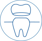 Veneers and Crowns Veneers and Crowns