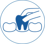 Extractions illustration of a tool pulling a tooth out depicting extracting a tooth