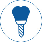 Implants Photo of a tooth with a screw in it for Implants